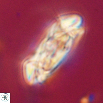 Cruciplacolithus staurion VR 30981