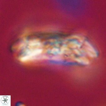 Cruciplacolithus staurion VR 30990