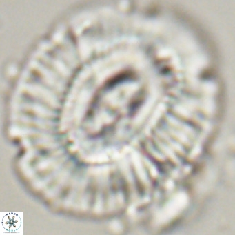 Cruciplacolithus staurion VR 31117