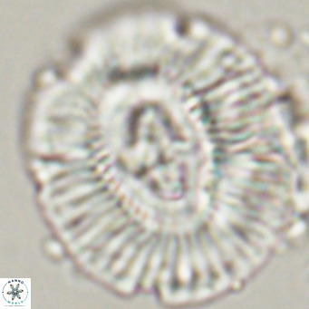 Cruciplacolithus staurion VR 31119