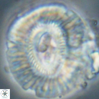 Cruciplacolithus staurion VR 31124