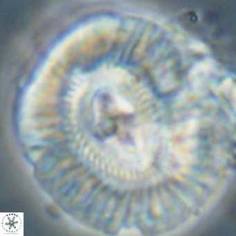 Cruciplacolithus staurion VR 31125
