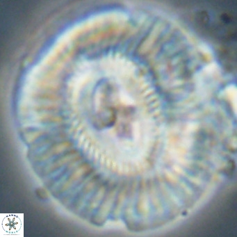 Cruciplacolithus staurion VR 31121