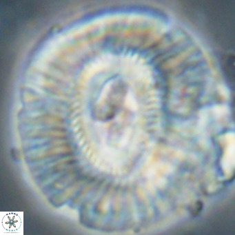 Cruciplacolithus staurion VR 31122