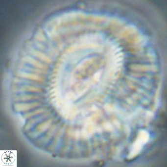 Cruciplacolithus staurion VR 31123