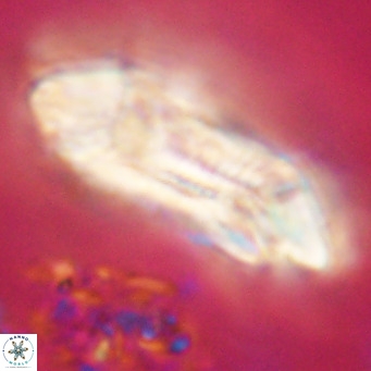 Cruciplacolithus staurion VR 31134