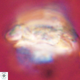 Cruciplacolithus staurion VR 31135