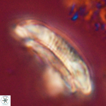 Cruciplacolithus staurion VR 31139