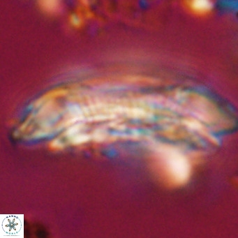 Cruciplacolithus staurion VR 31142