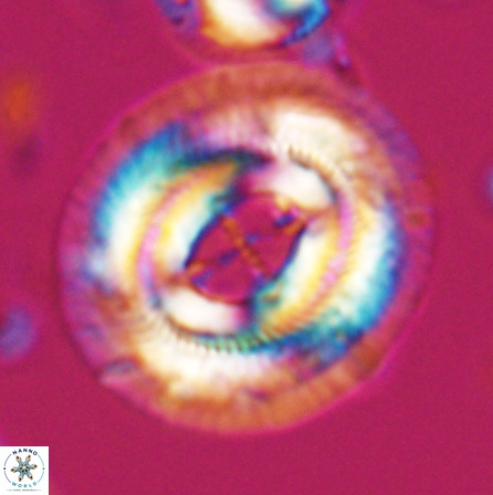 Cruciplacolithus staurion 25885