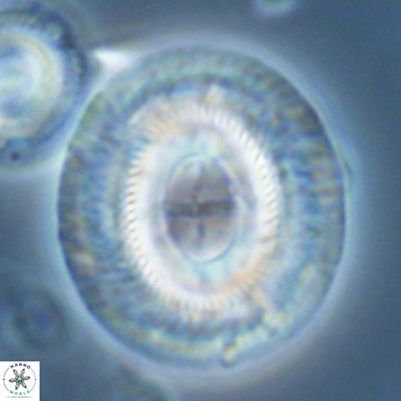 Cruciplacolithus staurion 25888