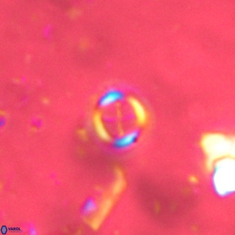 Cruciplacolithus subrotundus VR 00477