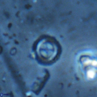 Cruciplacolithus subrotundus VR 00479