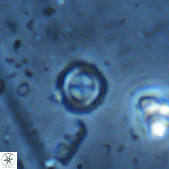 Cruciplacolithus subrotundus VR 00479
