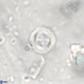 Cruciplacolithus subrotundus VR 00481