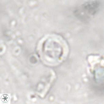 Cruciplacolithus subrotundus VR 00481