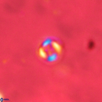 Cruciplacolithus subrotundus VR 01535