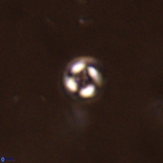 Cruciplacolithus subrotundus VR 01538