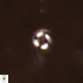 Cruciplacolithus subrotundus VR 01538
