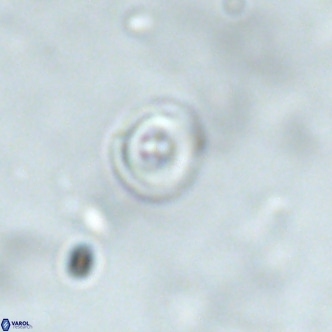 Cruciplacolithus subrotundus VR 01539