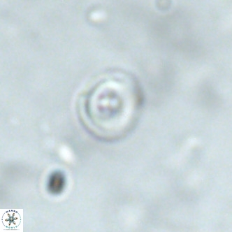 Cruciplacolithus subrotundus VR 01539