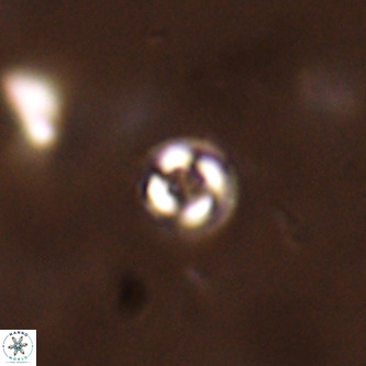 Cruciplacolithus subrotundus VR 01545