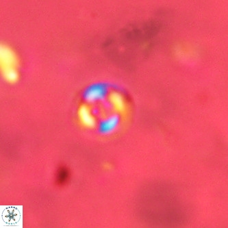 Cruciplacolithus subrotundus VR 01546
