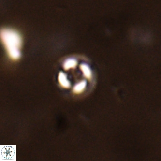 Cruciplacolithus subrotundus VR 01547