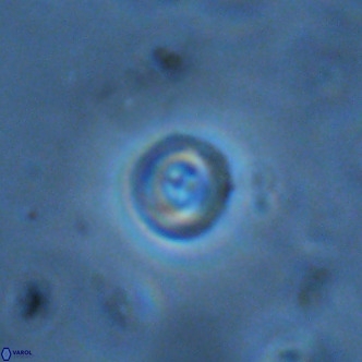 Cruciplacolithus subrotundus VR 01541