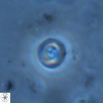 Cruciplacolithus subrotundus VR 01541