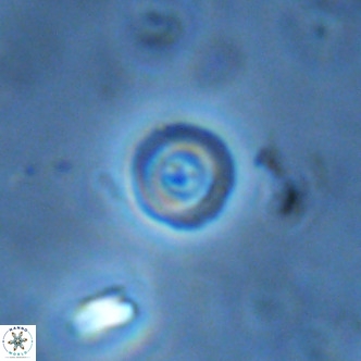 Cruciplacolithus subrotundus VR 01550