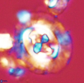 Cruciplacolithus tenuis 42670