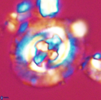 Cruciplacolithus tenuis 42671