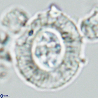 Cruciplacolithus tenuis 42673