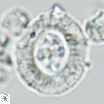 Cruciplacolithus tenuis 42673