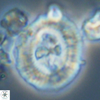 Cruciplacolithus tenuis 42675