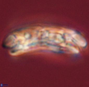 Cruciplacolithus tenuis 45616