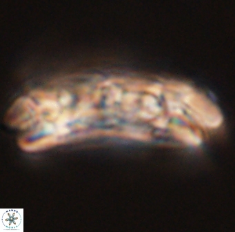 Cruciplacolithus tenuis 45617