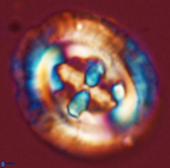 Cruciplacolithus tenuis 45621