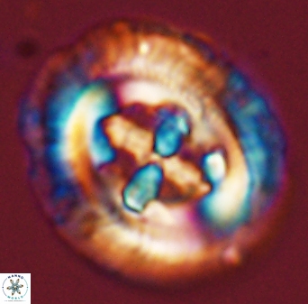 Cruciplacolithus tenuis 45621