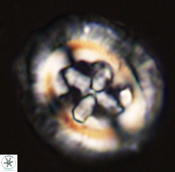 Cruciplacolithus tenuis 45622