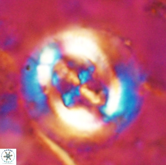 Cruciplacolithus tenuis 49685