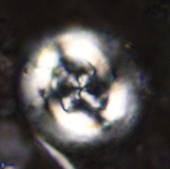 Cruciplacolithus tenuis 49686