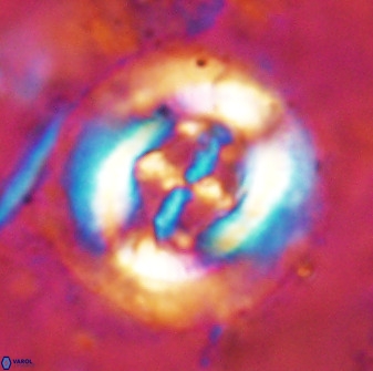 Cruciplacolithus tenuis 49688