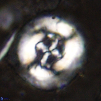 Cruciplacolithus tenuis 49690