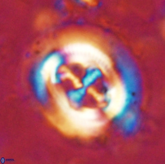 Cruciplacolithus tenuis 50289