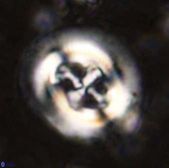 Cruciplacolithus tenuis 50290