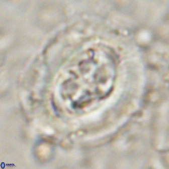 Cruciplacolithus tenuis 50293