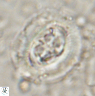 Cruciplacolithus tenuis 50293