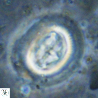 Cruciplacolithus tenuis 50294